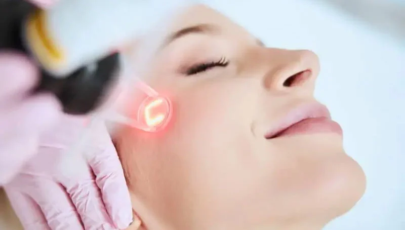 Tratamente Laser în Dermatologie Medicală