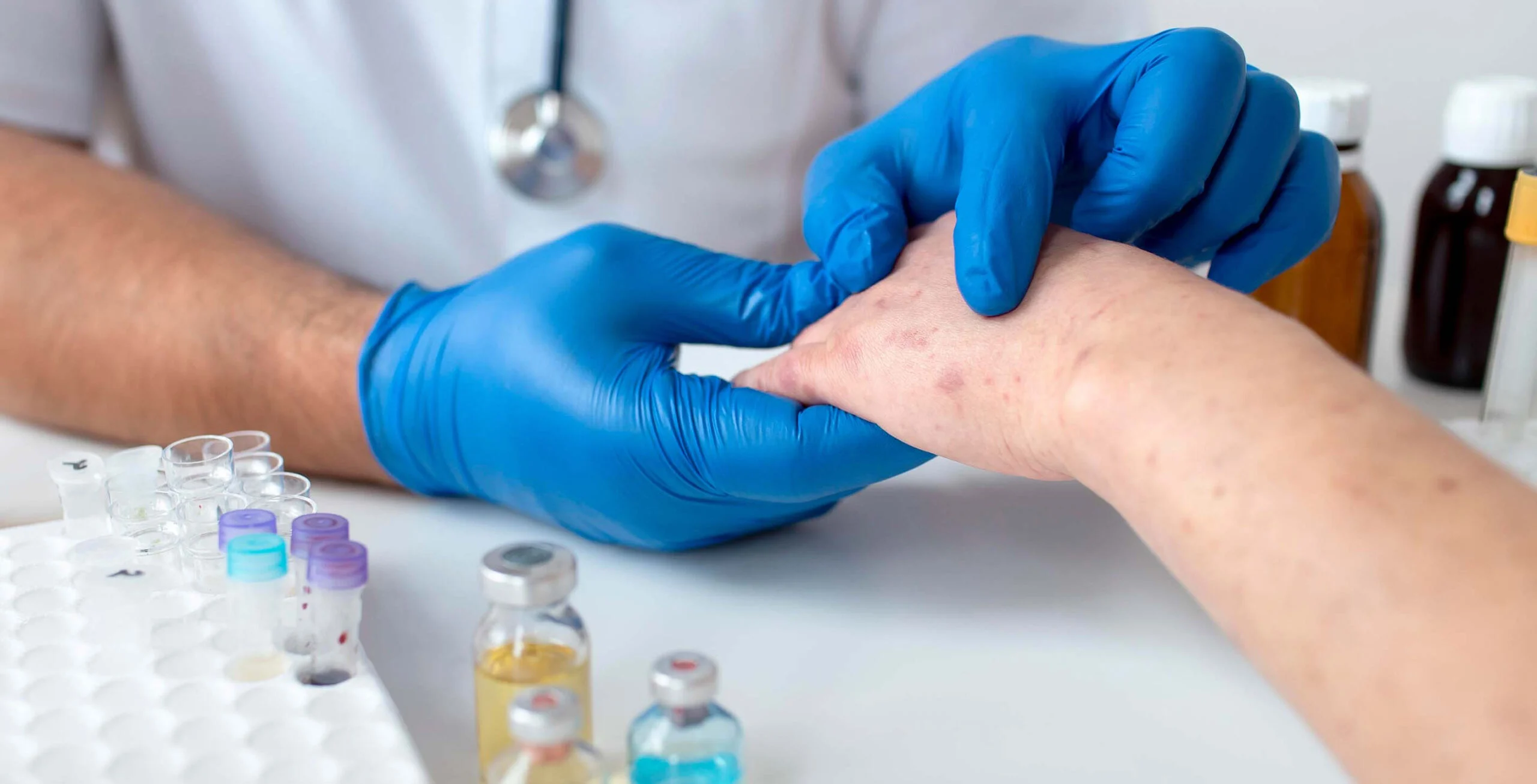 Proceduri Dermatologice