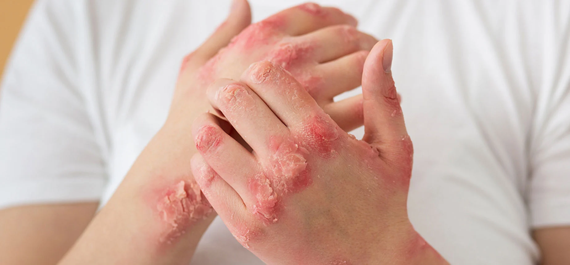 Afecțiuni dermatologice frecvente