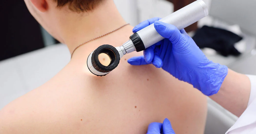Consultații Dermatologice & Dermatoscopie