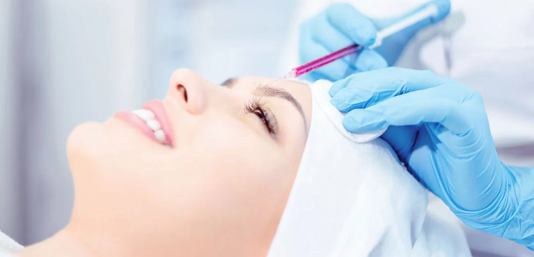 Remodelare și volumizare cu acid polilactic (Sculptra)