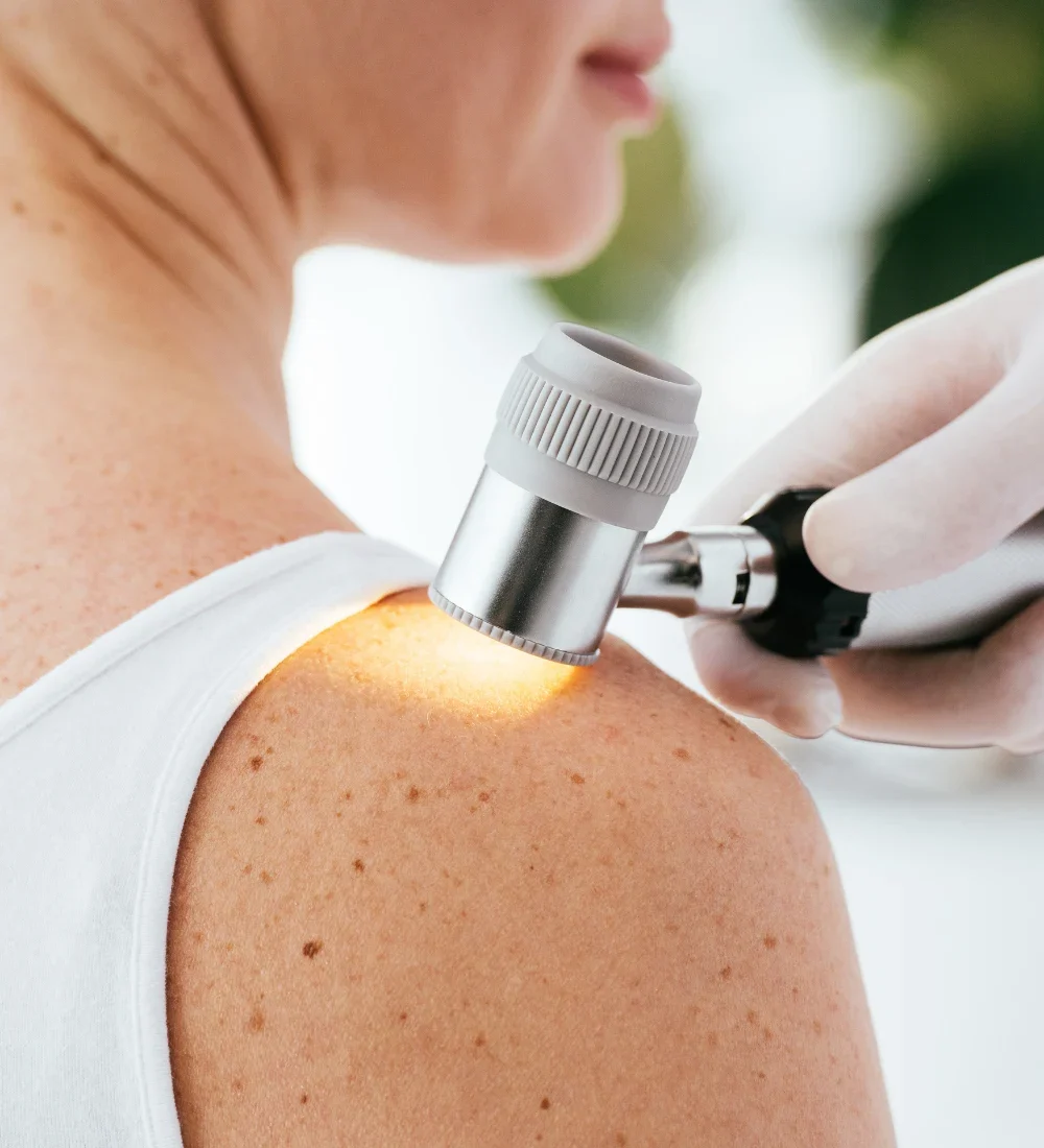 interventii-dermatologice